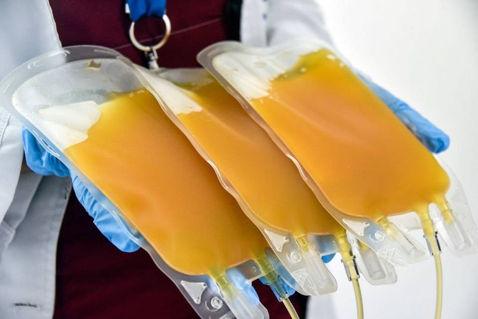 Uso de plasma sanguíneo hiperinmune para pacientes Covid-19
