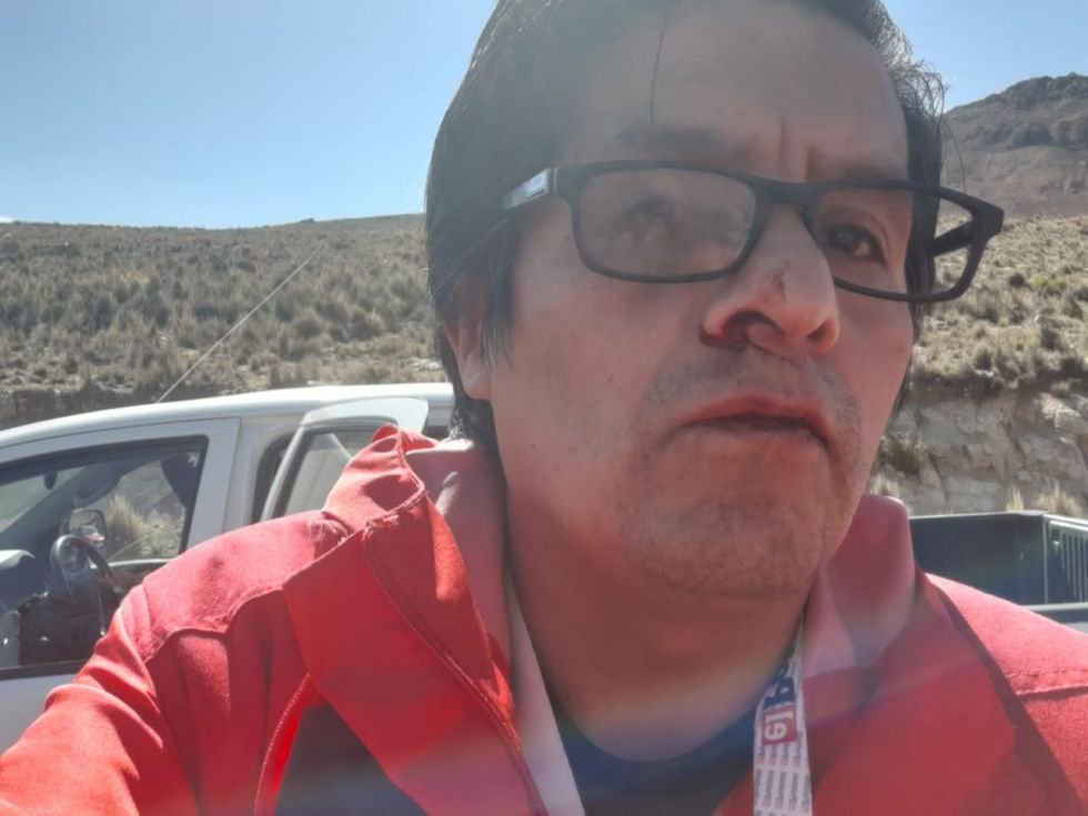 Periodista golpeado en Potosí