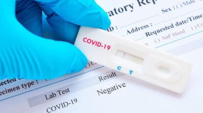 Reinfección de Covid-19 en joven de 25 años
