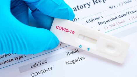 Reinfección de Covid-19 en joven de 25 años