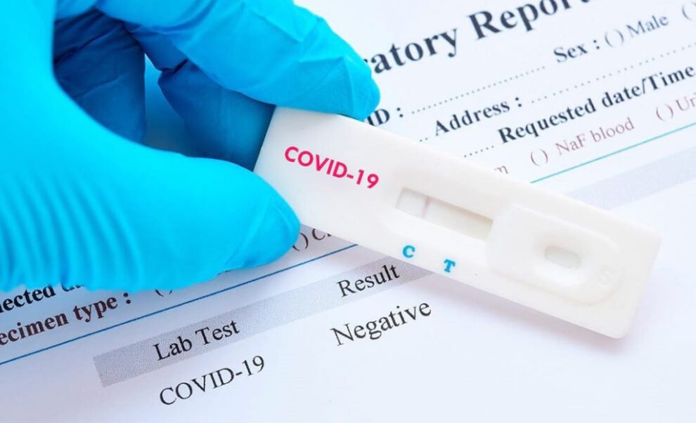 Reinfección de Covid-19 en joven de 25 años