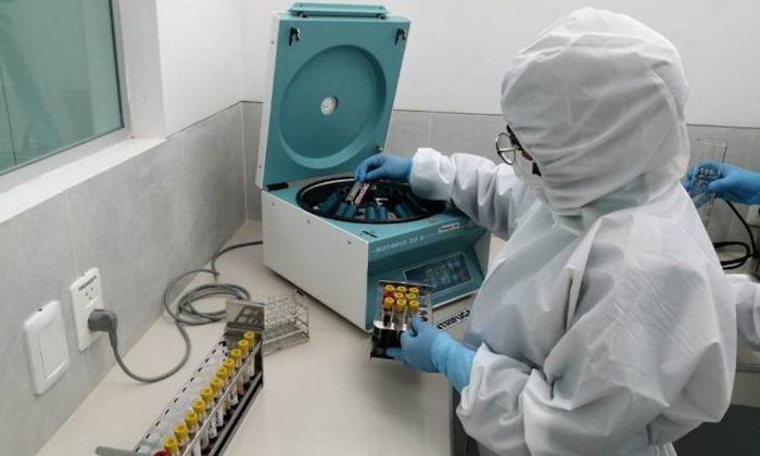 Covid-19: Ministerio de Salud reporta 126 nuevos casos en un día