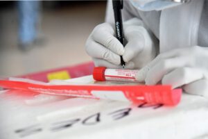 Covid-19 en Bolivia: 144.810 casos positivos reportados