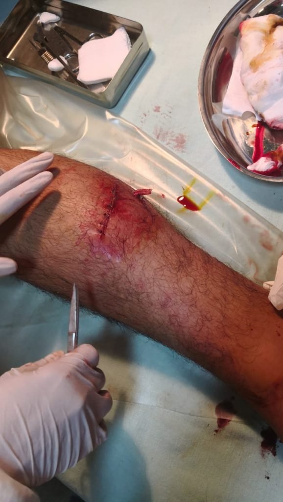 nuevo ataque de can cerca de la FNI