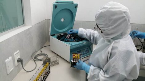 Laboratorios privados de Cochabamba al borde del colapso por alta demanda de pruebas de Covid-19