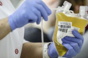 Plasma sanguíneo para tratar el Covid-19