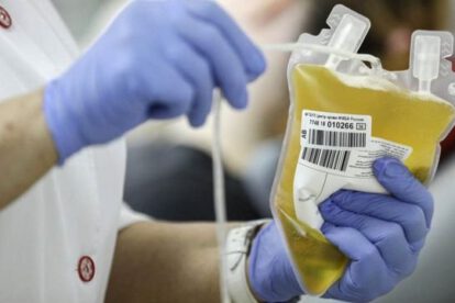 Plasma sanguíneo para tratar el Covid-19