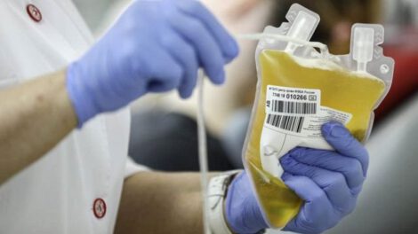 Plasma sanguíneo para tratar el Covid-19