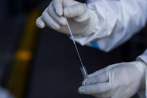 Test anales Covid-19 en España