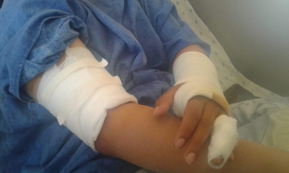 Ataque de canes en Caracollo dejó a profesora herida