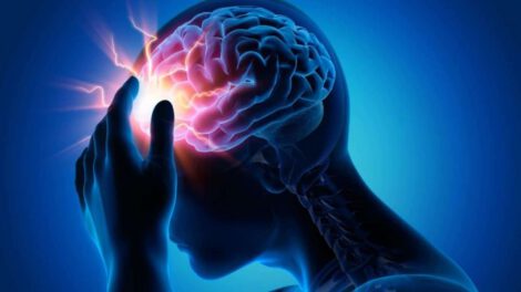 Ceguera cortical por Covid-19