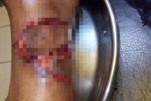 Anciana atacada por perro mientras pastaba sus ovejas