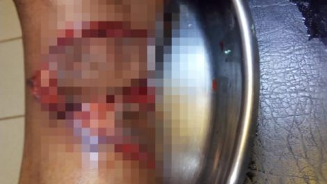Anciana atacada por perro mientras pastaba sus ovejas