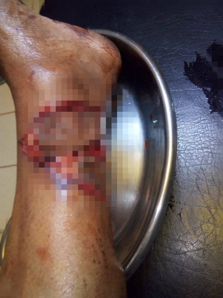Anciana atacada por perro mientras pastaba sus ovejas