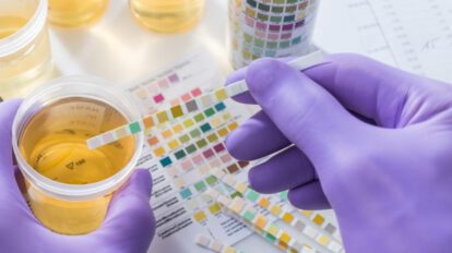 Cáncer de útero detectado por test de orina