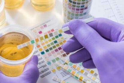 Cáncer de útero detectado por test de orina