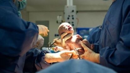Anticuerpos contra el Covid-19 en bebé recién nacida