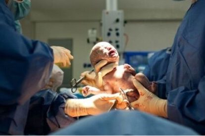 Anticuerpos contra el Covid-19 en bebé recién nacida