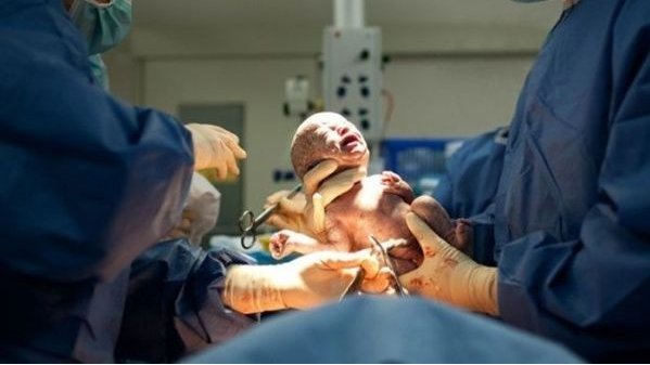 Anticuerpos contra el Covid-19 en bebé recién nacida