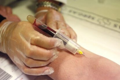 Análisis de sangre sobre Covid-19 y grupo sanguíneo A