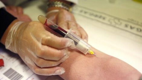 Análisis de sangre sobre Covid-19 y grupo sanguíneo A