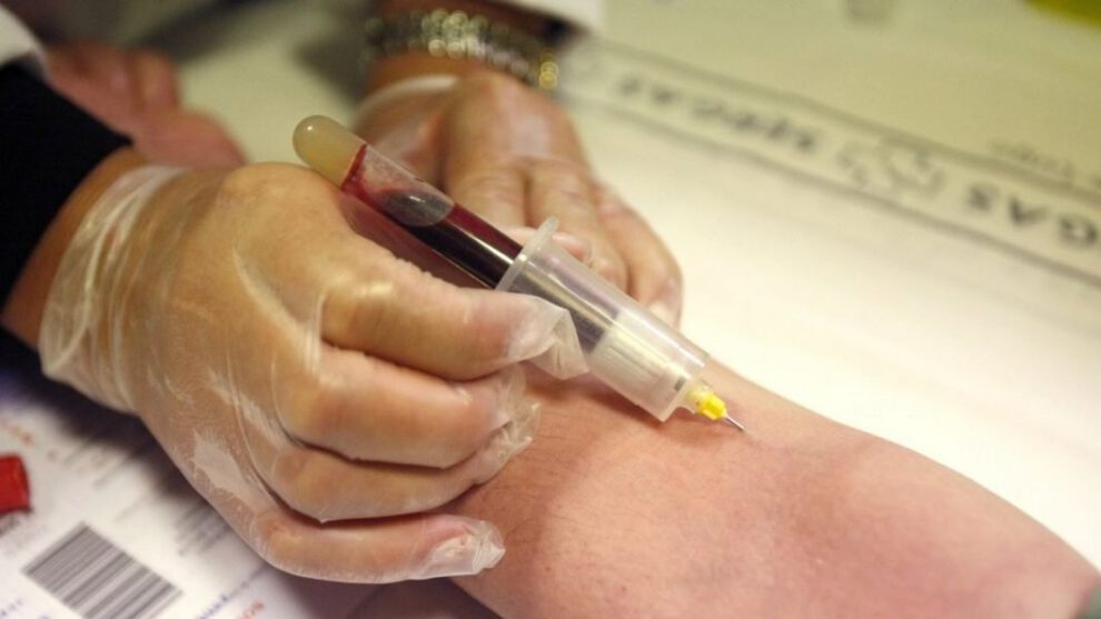 Análisis de sangre sobre Covid-19 y grupo sanguíneo A