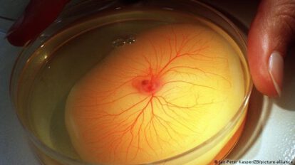Investigaciones sobre la vacuna AstraZeneca y trombosis