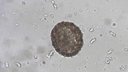 Arenavirus y vigilancia epidemiológica en La Paz