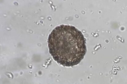 Arenavirus y vigilancia epidemiológica en La Paz