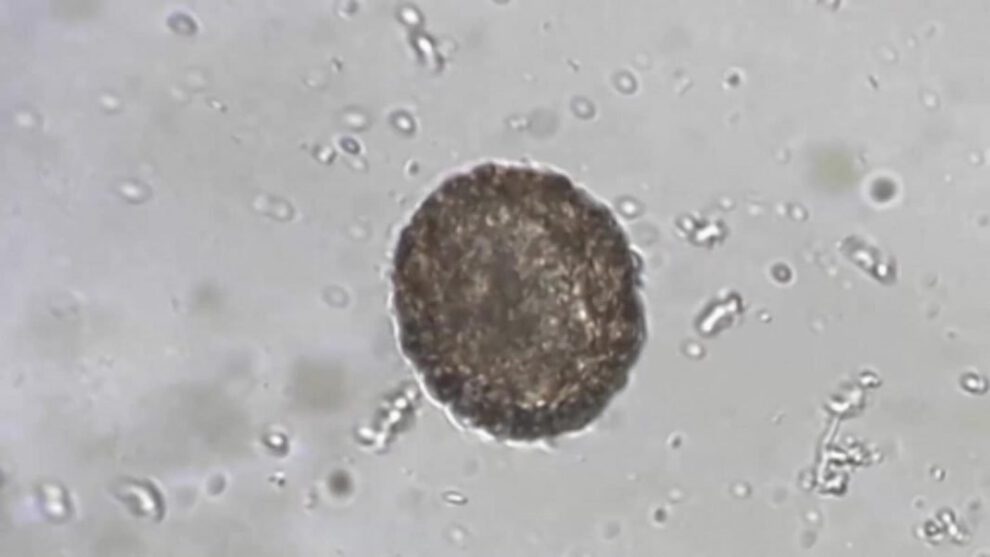 Arenavirus y vigilancia epidemiológica en La Paz