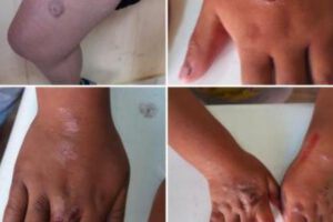 Agresiones físicas a menores en Potosí
