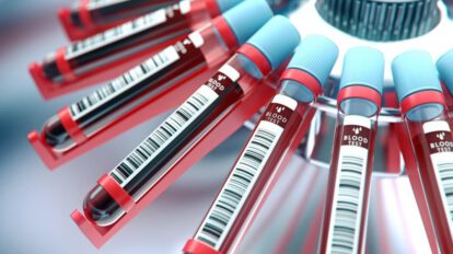 Suero anticovid para pacientes con Covid-19