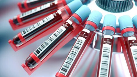 Suero anticovid para pacientes con Covid-19