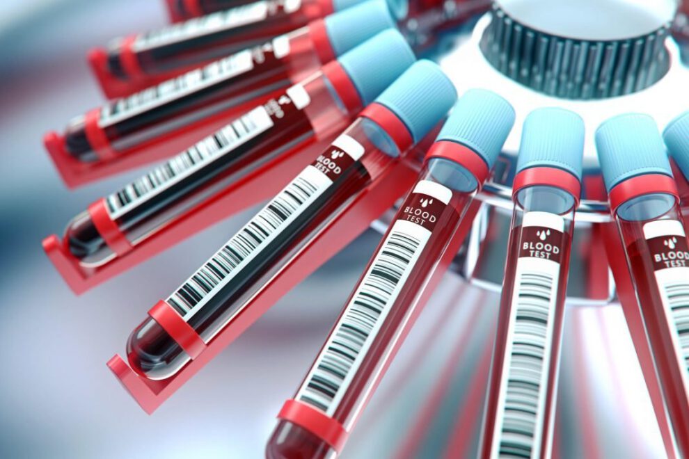 Suero anticovid para pacientes con Covid-19
