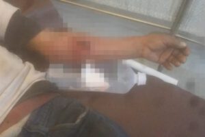 Ataque de can en Oruro
