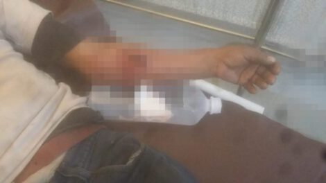 Ataque de can en Oruro