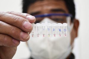 Covid-19 en Bolivia reporta más de 1.700 nuevos casos