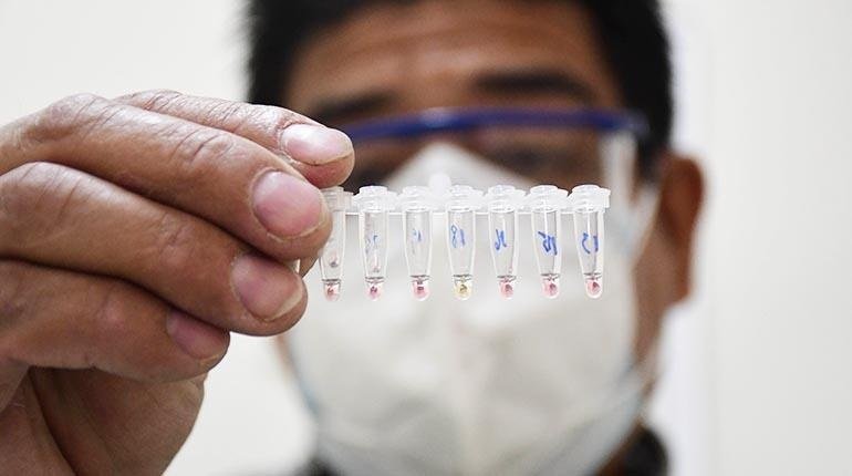 Covid-19 en Bolivia reporta más de 1.700 nuevos casos