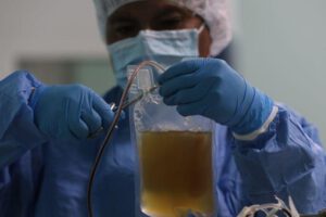 Suero anticovid con plasma de burros en Bolivia