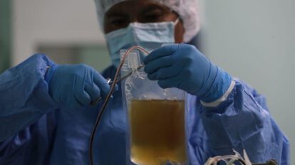 Suero anticovid con plasma de burros en Bolivia