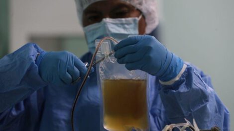 Suero anticovid con plasma de burros en Bolivia