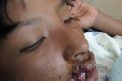 Adolescente mordido por perro pastor alemán