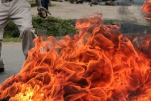 Anciano quemado por su hijo en Yacuiba