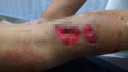 Ataque de can a niña de 10 años en Oruro