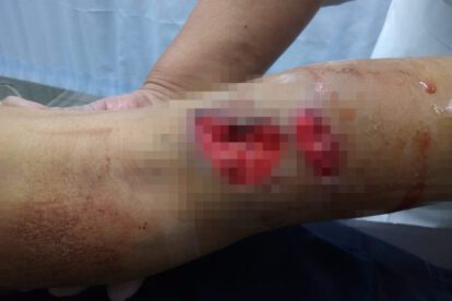 Ataque de can a niña de 10 años en Oruro
