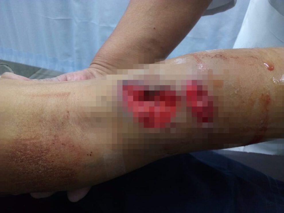 Ataque de can a niña de 10 años en Oruro