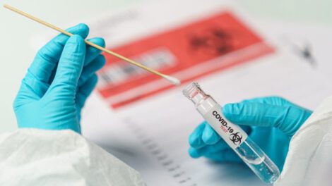 Pruebas vencidas de antígeno nasal