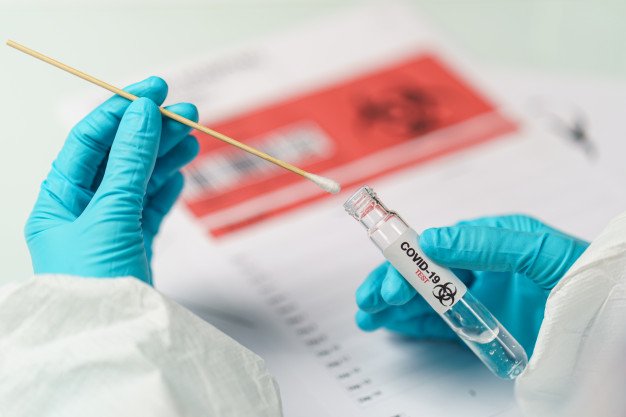 Pruebas vencidas de antígeno nasal