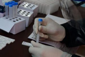 Covid-19 en Bolivia reporta 1.598 casos nuevos y 57 decesos