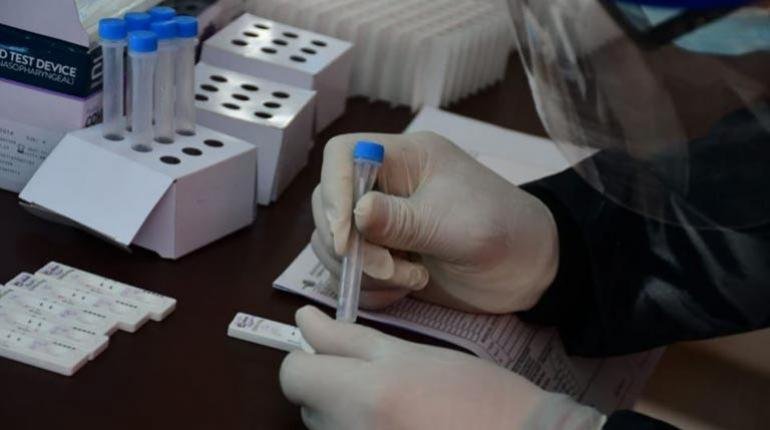 Covid-19 en Bolivia reporta 1.598 casos nuevos y 57 decesos